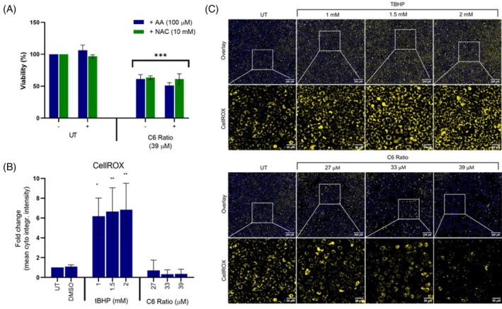 The effect of the cannabinoid ratio on ROS generation in the MCF7 cell line. (A) The effect of concomitant treatment with AA and NAC on the viability of cells treated with the cannabinoid ratio, was determined using the crystal violet assay. (B, C) The effect of treatment with tBHP and the cannabinoid ratio on ROS generation, was determined using CellROX™ Orange staining. Image acquisition (10× objective, scale bar = 200 μM and 50 μM) and analysis were completed using the ImageXpress High‐Content Analysis System (n = 3, data are presented as mean ± SD, *significant to untreated control; *p < 0.05; **p < 0.01; ***p < 0.001). AA, ascorbic acid; DMSO, dimethyl sulfoxide vehicle control; NAC, N‐acetyl cysteine; TBHP, tert‐butyl hydroperoxide; UT, untreated.
