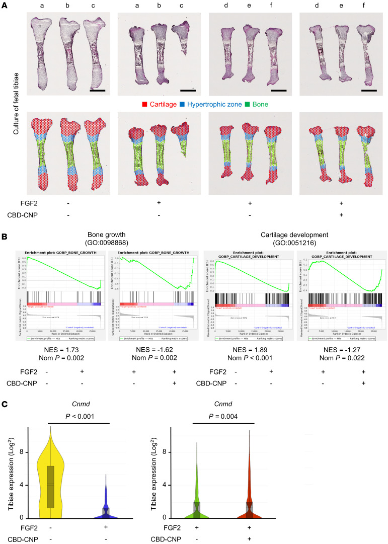 Pharmacological effects of CBD-CNP on bone growth revealed with spatial transcriptomics.(A) H&E staining and sectioning of Visium Spatial Gene Expression Slides of fetal murine tibiae. The tibiae labeled by letter indicates samples from the same patient. (B) Gene set enrichment analysis of hypertrophic zones in spatial transcriptomics. (C) Violin plots of gene expression in total tibiae. Scale bars: 1 mm in A. Statistical analysis was performed using the Student’s t test. NES, normalized enrichment score; Nom, nominal; Cnmd, chondromodulin.