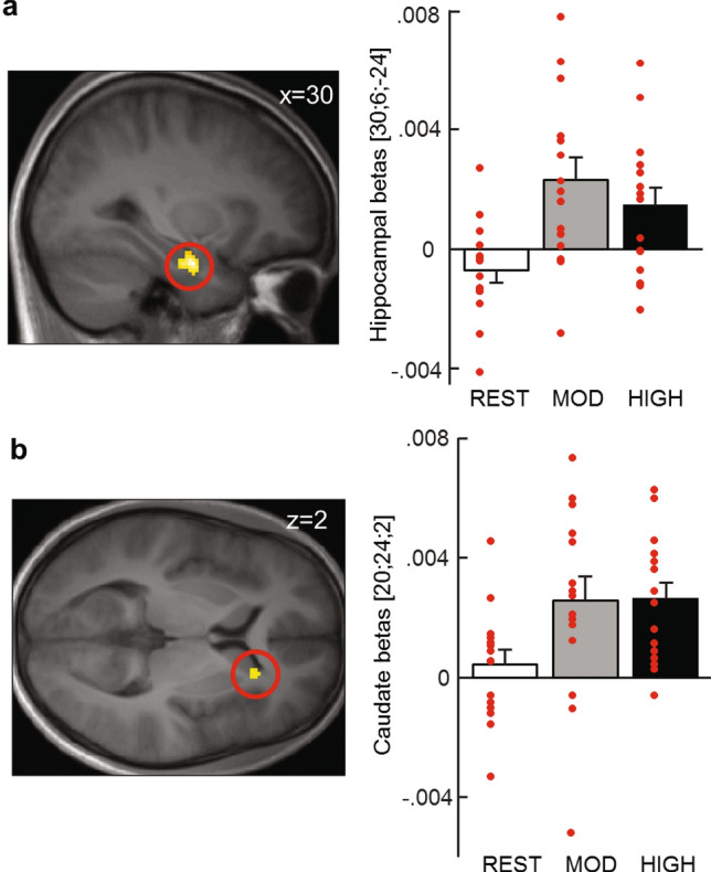 Increased activity in right hippocampus and right caudate for exercise > rest pmod—RT during Session 2. Left: fMRI activations in (a) right hippocampus (peak at [30; − 6; − 24]) and (b) right caudate nucleus (peak at [20; 24; 2]) during Session 2 of the SRTT task after moderate and high intensity exercising conditions versus the rest Exercising Condition, with reaction times as trialwise parametric modulator. Right: betas for the fMRI activations. All reported activations survive SVC correction for a small volume defined from the AAL atlas in the WFU PickAtlas toolbox (Wake Forest University School of Medicine) for SPM12. For display purposes, activations are thresholded at p < 0.005. Error bars represent SEM.