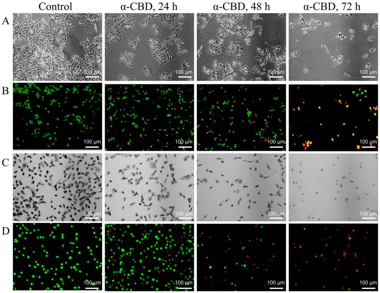 α-CBD induced morphological changes and plasma membrane abnormality in hepatoma carcinoma cells. (A) Morphological changes in HepG2 cells after α-CBD treatment; (B) AO/EB double-fluorescent staining of HepG2 cells treated with α-CBD; (C) Morphological changes in SMMC-7721 cells after α-CBD treatment; and (D) AO/EB double-fluorescent staining of SMMC-7721 cells treated with α-CBD.