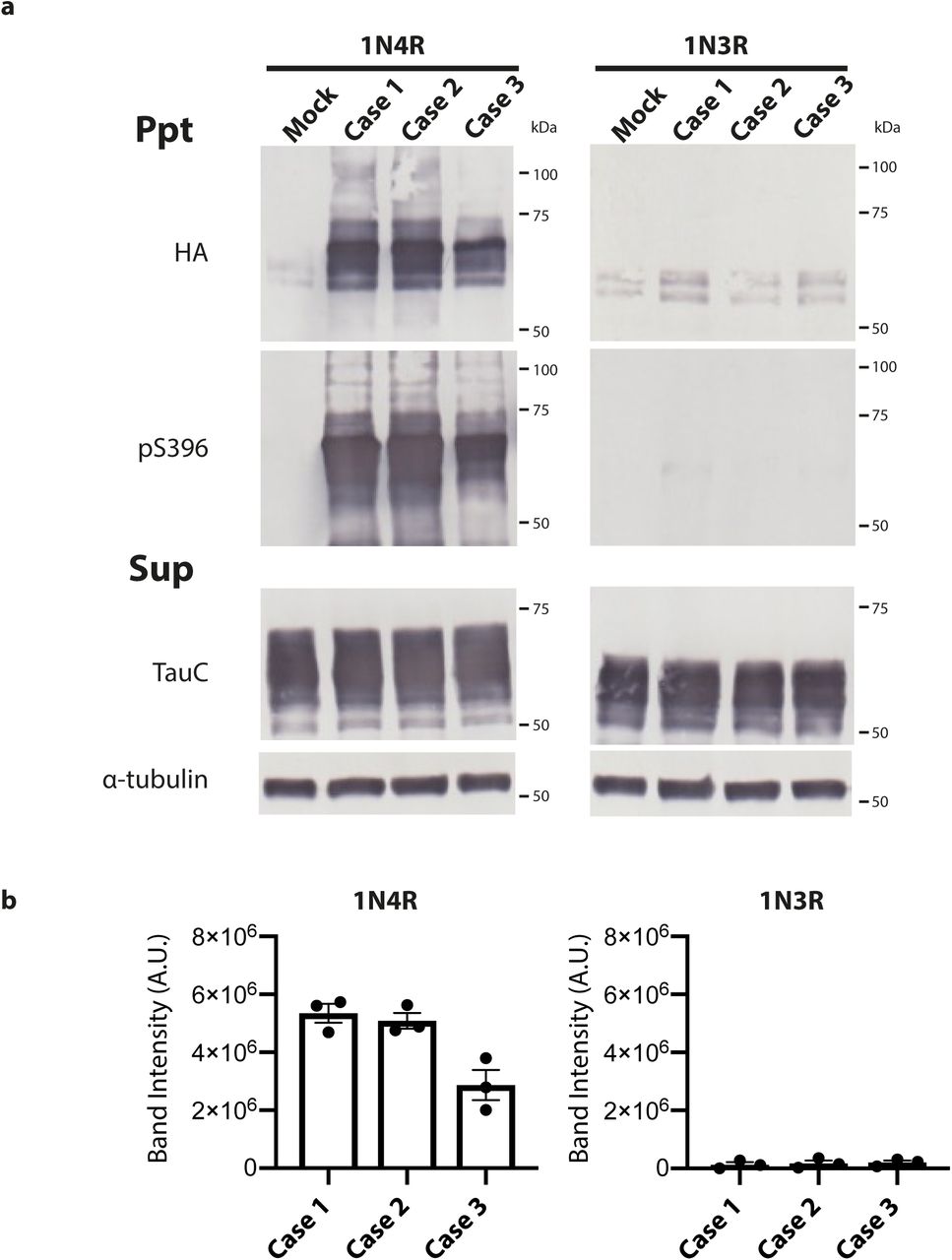 Seeded tau aggregation induced by CBD filaments in SH-SY5Y cells.a, Immunoblotting of sarkosyl-insoluble (Ppt) and sarkosyl-soluble (Sup.) fractions extracted from mock-transfected SH-SY5Y cells and from cells transfected with tau seeds from frontal cortex of CBD cases 1-3. SH-SY5Y cells transiently expressed either hemagglutinin (HA)-tagged 1N4R or HA-tagged 1N3R human tau. Insoluble tau was detected with anti-HA and anti-pS396 tau antibodies. Total tau was detected with anti-TauC. Blotting with an anti-α-tubulin antibody served as loading control. b, Quantitation of anti-HA-positive bands. The results are expressed as the means ± S.E.M. (n=3).