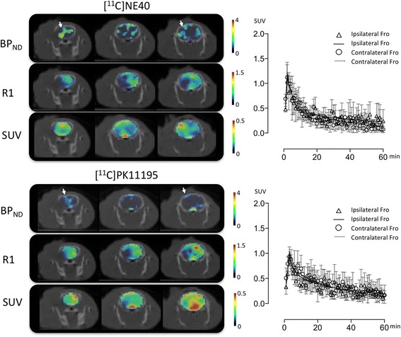 Coronal parametric images of BPND, R1, and SUV (standardized uptake value) superimposed on X-CT images in [11C]NE40 and [11C](R)PK11195 studies. A SUV image was generated as a summation of tracer uptake during 40–60 min post-injection. The arrows indicate the peri-infarct region (penumbra). Mean tissue time-activity curves with standard deviations of each tracer on both frontal cortices are shown in different panels. Ipsilateral, lesion side; contralateral, non-lesion side