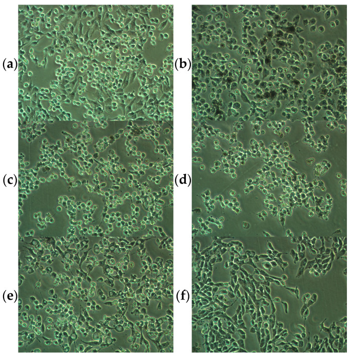Morphology of murine melanoma B16F10 cells grown for 48 h in the presence of (a) DMSO (untreated, αMSH- negative cells), (b) αMSH (10 nM, αMSH+ cells), (c) αMSH + CBD (5 μg/mL), (d) αMSH + CBG (5 μg/mL), (e) αMSH + CBN (5 μg/mL), (f) αMSH + CBC (5 μg/mL); 10× magnification; pictures are representative for three experiments.