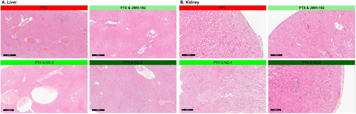 Histological slides show liver and kidney tissues under different conditions. The liver (left side) is shown under PTX, PTX & JWH-182, PTX & NC-1, and PTX & NC-2 treatments. The kidney (right side) is shown under the same conditions. Each section displays tissue morphology with various cellular structures, stained pink, highlighting different histological changes.
