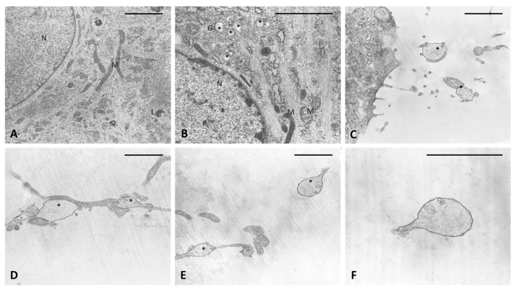TEM analysis. (A) Control cells. (B–F) cells treated for 4 h with HU-308 2.5 µM. (B) in vesicles are visible in cytoplasm and close to Golgi complex (*). (C–E) vesicles on cytoplasmic extensions of cells or just excreted vesicles. (F) Detail of an exocytosed vesicle, showing amorphous material inside. Scale bars: 2 µm. N: nucleus. M: mitochondria. L: lysosome. G: Golgi complex. *: vesicles.