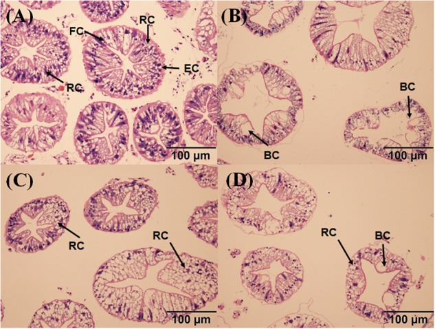 Effects of the vitamin A on the Aroclor 1254-mediated microstructure of hepatopancreas; control group (A), PCB-only group (B), PVA80K group (C), PVA240K group (D); resorptive cell RC (R cell), blister-like cell BC (B cell), fibrillar cell FC (F cell).