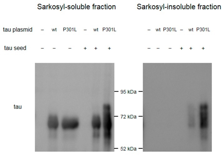 Western blot results to validate the seeding potential of the tau seeds made. Western blot of the sarkosyl-soluble fractions using anti-tau (HT7) antibodies shows ≈65 kDa band in cell samples transfected with wild-type (wt) tau or P301L tau. Higher molecular weight bands appear in cell samples transfected with both tau plasmids and tau seeds. Western blot of the sarkosyl-insoluble fractions shows bands only in cell samples transfected with both tau plasmids and tau seeds, which showed higher signal in the cell sample transfected with P301L tau plasmid.