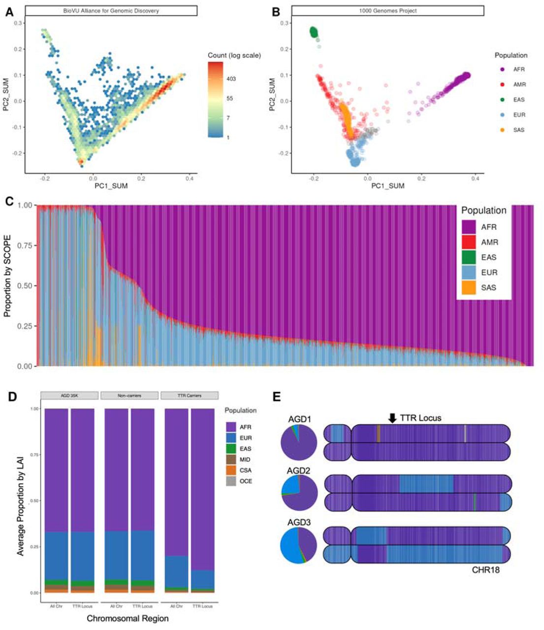 Global and local ancestry inference (LAI) in the AGD35k cohort.A) Density plot of the BioVU Alliance for Genomic Discovery (AGD35K) participants genomic data projected into 1000 Genomes Project (1kGP + Human Genome Diversity Project (HGDP) principal component space. B) 1kGP participant data projected into the same principal component space (AFR – African, AMR – American, EAS – East Asian, EUR – European, SAS – South Asian). C) Ancestry proportion estimates of BioVU AGD35k participants calculated using supervised SCOPE analysis and allelic frequencies from the 1kGP. Each bar represents a single participant, and bars are ordered by the proportion of African ancestry. D) Proportion of participants genome by continental ancestry based on LAI from the 1kGP + HGDP reference panel (AFR- African, EUR- European, EAS- East Asian, MID- Middle Eastern, CSA- Central South Asian, OCE- Oceanic) for TTR pathogenic variant carriers, non-carriers and the total AGD35k population. E) Painted karyograms for chromosome 18 from three representative TTR carriers (V142I). Arrow annotates the TTR locus. LAI-derived global ancestry proportions for each participant are represented to the left of the karyograms as pie charts. AGD1 and AGD2 represent two TTR carriers with varying, but majority AFR global ancestry (92.6% and 72.5%, respectively). AGD3 represents a TTR carrier with majority EUR global ancestry (53.8%) and AFR ancestry at the TTR locus.