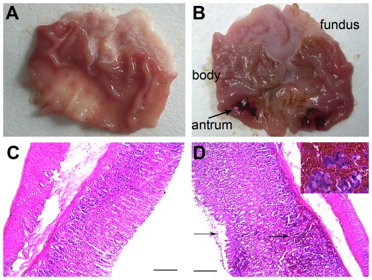 Morphological changes of the isolated stomach from rats with or without experimental acute pancreatitis.(A) Stomach from a control rat. (B) Stomach from an AP rat, showing severe edema and hemorrhages on the gastric antrum (arrowheads). (C) A representative tissue section of the stomach of a control rat, and (D) A representative tissue section of the stomach of an AP rat (hematoxylin and eosin staining, with original magnification ×100; the scale bar = 100 µm). The hemorrhages and mucosal erosions were observed and marked with arrowheads.