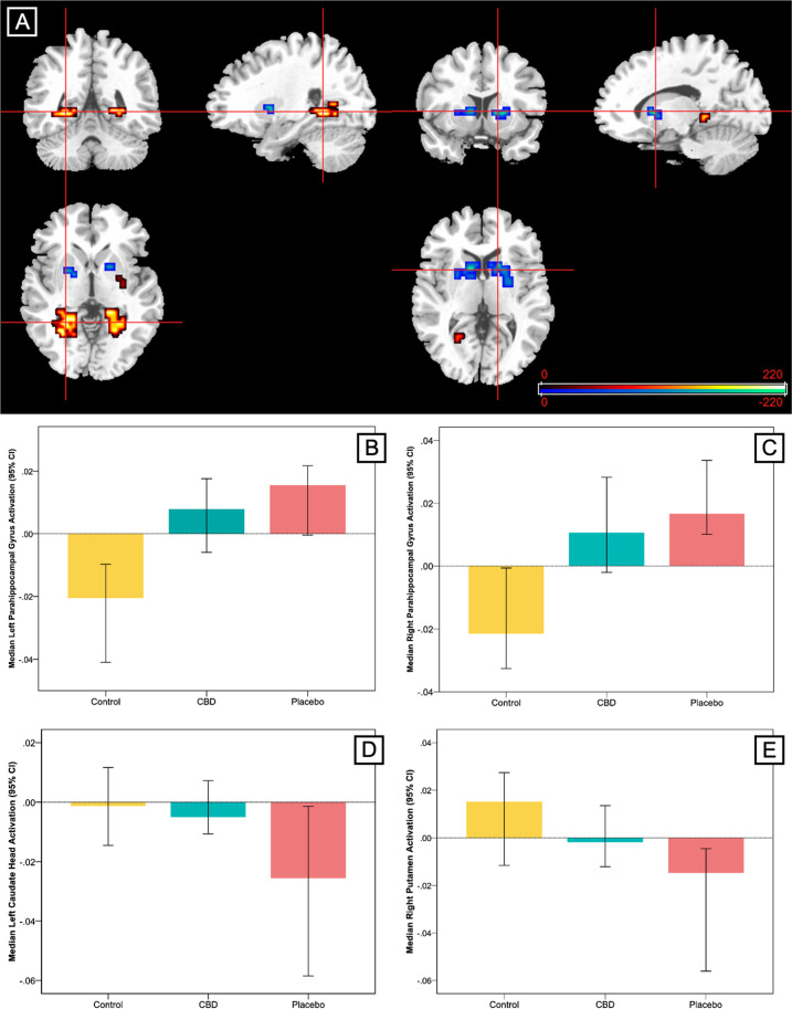 Effect of cannabidiol (CBD) on brain activation compared with placebo in participants at clinical high risk of psychosis (CHR) and healthy control participants.a Clusters where activation differed across the three groups in a linear relationship during fear processing. In the parahippocampal region (red/yellow), activation was greatest in the group of clinical high risk participants receiving placebo, lowest in healthy controls and intermediate in the CBD group. In the striatum (blue/green), activation was greatest in healthy controls, lowest in participants at clinical high risk receiving placebo and intermediate in participants at clinical high risk receiving CBD. The right side of the brain is shown on the right of the images. b–e Median activation in each group in b the left parahippocampal gyrus, c the right parahippocampal gyrus, d left caudate head and e right putamen during fear processing in arbitrary units as indexed using the median sum of squares ratio. The sum of squares ratio statistic refers to the ratio of the sum of squares of deviations from the mean image intensity due to the model (over the whole time series) to the sum of squares of deviations due to the residuals.