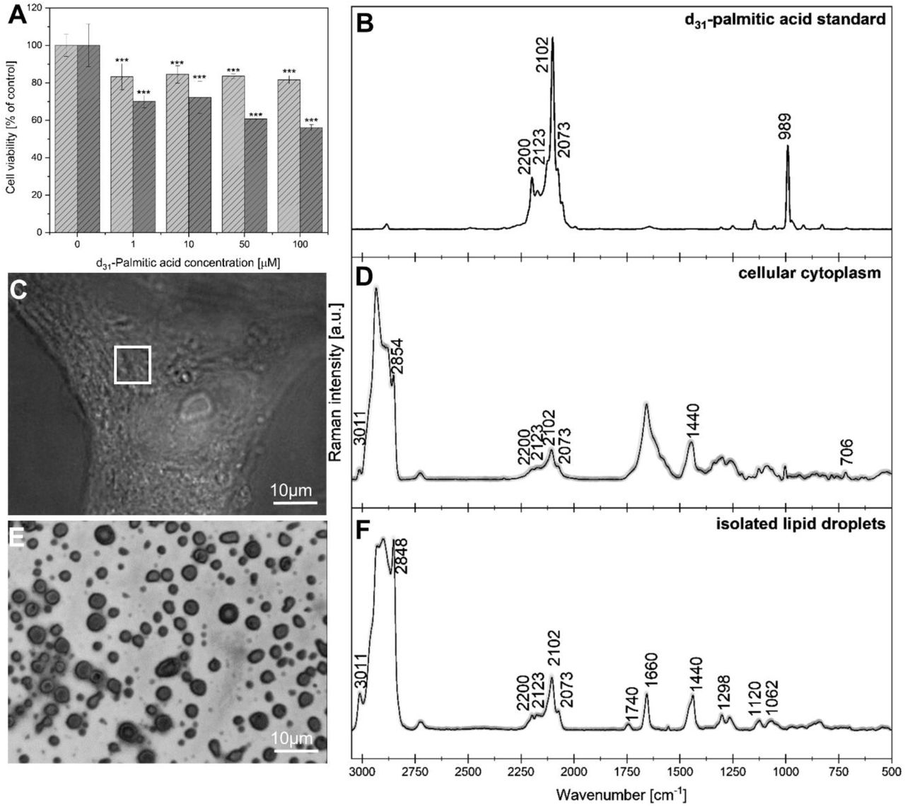 Results of the MTS assay performed on Schwann (light grey) and MPNST (dark grey) cell lines treated with increasing concentrations of acid d31-PA (A). Raman spectrum of the pure d31-PA standard (B). Brightfield image of a cell treated with 10 µM d31-PA with the region selected for Raman imaging indicated (C) together with the corresponding Raman spectrum acquired from the cytoplasm showing accumulation of d31-PA (D). Brightfield image of dried iLDs (E) with representative Raman spectra confirming their biochemical composition and the presence of incorporated d31-PA (F).