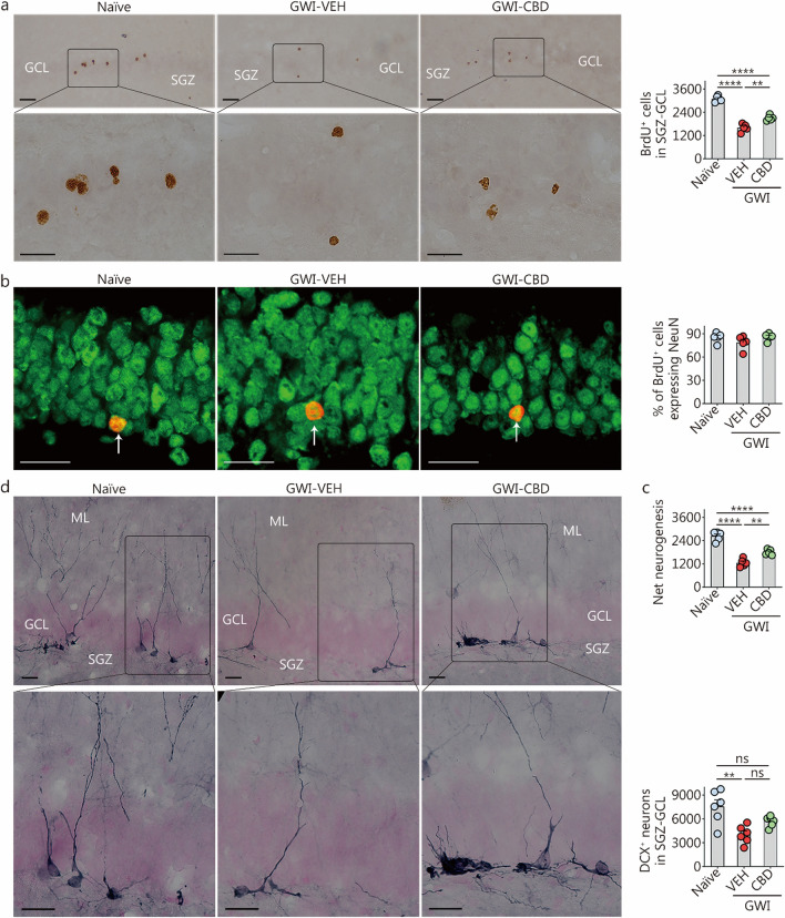 CBD treatment enhanced net hippocampal neurogenesis and the status of hippocampal neurogenesis in rats with chronic Gulf War Illness (GWI). a Figures illustrate examples of BrdU+ newly born cells in the SGZ-GCL of the hippocampus from naïve control, GWI-VEH, and GWI-CBD groups (scale bar = 25 µm). The bar chart compares the number of BrdU+ newly born cells in the SGZ-GCL of the hippocampus across groups. b Figures illustrate examples of BrdU+ cells expressing the neuronal marker, NeuN (arrows) from naïve control, GWI-VEH, and GWI-CBD groups (scale bar = 25 µm). Arrows denote BrdU+ cells expressing the neuronal marker NeuN. Bar charts compare percentages of BrdU+ cells expressing NeuN across groups. c The bar chart compares net hippocampal neurogenesis in the SGZ-GCL of the hippocampus across groups. d Figures illustrate examples of DCX+ newly born neurons from naïve control, GWI-VEH, and GWI-CBD groups (scale bar = 25 µm). The bar chart compares the number of DCX+ neurons between different groups. **P < 0.01, ****P < 0.0001, ns non-significant. Please refer to Table S3 in Additional file 1 for detailed statistical information. CBD cannabidiol, BrdU 5’-bromodeoxyuridine, VEH vehicle, NeuN neuron-specific nuclear antigen, DCX doublecortin, ML molecular layer, GCL granule cell layer, SGZ subgranular zone
