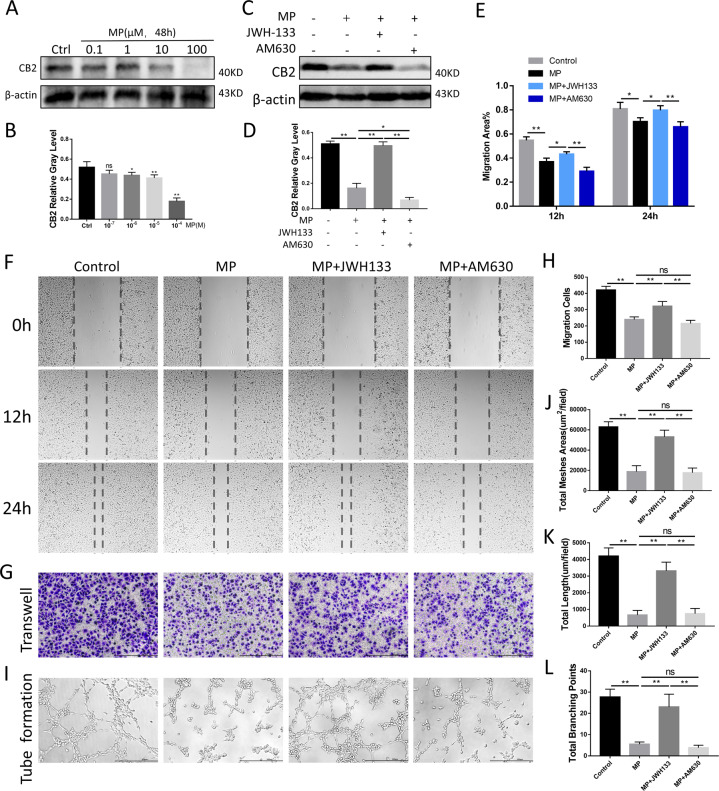Angiogenesis was promoted by CB2 under MP intervention in vitro.A, B CB2 expression under different concentration of MP for 48 h. C, D Expression of CB2 under MP, JWH133, and AM630 intervention. E, F Scratch assay for 0, 12, and 24 h. G, H Transwell assay, and migration cells. I–L Tube formation and quantitative analysis (n = 3 per group, data are shown as mean ± SD, *p < 0.05; **p < 0.01; ns, not significant).