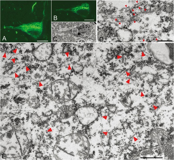 Correlation of immunolabeled LM and EM images of CBD-pretangles. Reticular tau immunoreactivity in the cytoplasm in a pretangle neuron of CBD (case 3) labeled with anti-tau antibody (AT8) visualized with QD 655, also labeled with Alexa 488 for more precise confocal images (A). When compared between LM (B) and its exact EM counterpart, reticular tau immunoreactivity in the cytoplasm (C, rectangle e) was composed of randomly distributed straight filaments (E, arrowheads). Tau immunoreactivity in the dendrite (C, rectangle d) on LM corresponded to a few 15-nm straight filaments assembled roughly in parallel. Their arrangement was less tight than that in NFTs in AD. Scale bars in A-C = 10 μm; D = 250 nm; E = 500 nm.