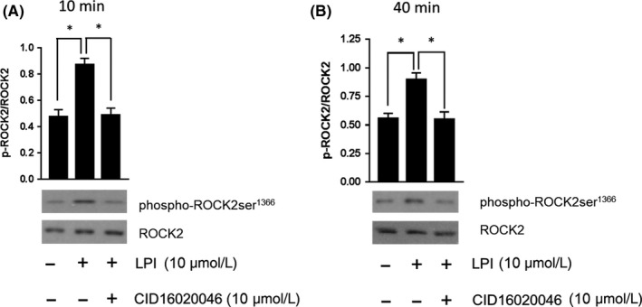 LPI‐induced ROCK2 phosphorylation is a sustained response. Both short (10 minutes; Panel A) and prolonged (40 minutes; Panel B) exposure to LPI demonstrated sustained ROCK2 phosphorylation in murine iPSC cardiomyocytes. A second GPR55 antagonist CID16020046 (10 μmol L−1) prevented the response at both timepoints, providing further supporting evidence that the effect of LPI is mediated through GPR55. Data (mean ± SEM) are expressed as the ratio of phosphorylated to total ROCK (corrected for protein content); n = 3 experiments performed on separate cell preparations. Western Blots are representative results. *P < 0.05 vs LPI response