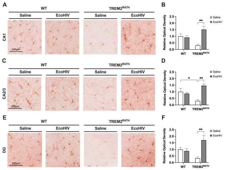 EcoHIV increases hippocampal IBA1 expression in TREM2R47H mice. (A) IBA1-immunostained vibratome sections in the CA1 sub-region of the hippocampus from wild type (WT) mice and TREM2R47H mice treated with saline or EcoHIV. (B) Relative optical density quantification of IBA1 in CA1 sections. (C) IBA1-immunostained vibratome sections in the CA2/3 sub-region of the hippocampus of WT mice and TREM2R47H mice treated with saline or EcoHIV. (D) Relative optical density quantification of IBA1 in CA2/3 sections. (E) IBA1-immunostained vibratome sections in the DG sub-region of the hippocampus of WT mice and TREM2R47H mice treated with saline or EcoHIV. (F) Relative optical density quantification of IBA1 in DG sections. Scale bars represent 100 μm. Data presented as mean ± SEM normalized to WT-saline controls and analyzed using two-way ANOVA with Holm–Sidak’s multiple comparisons tests; n = 4–6 per condition; statistical significance was determined at * p < 0.05, ** p < 0.001. Abbreviations: IBA1, ionized calcium-binding adapter molecule 1; CA, cornu ammonis; DG, dentate gyrus.
