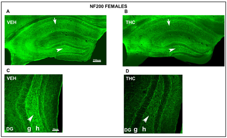 Confocal images at low magnification show abnormal immunolabeling of NF200 in THC female pups. NF200-ir (green labeling; A–D) in the HIPP of VEH (A–C) and THC (B, D) pups at PND60. Note the decreased NF200-ir in the CA1 strata radiatum (arrow in B) and the hilus of DG in THC mice (arrowhead in B) compared to that in VEH (A,C) females. The decrease in NF200-ir in lacunosum-moleculare is not as significant as in male THC mice (B). Magnification of the hilus of the DG, the NF200-ir, is lower in the THC group (D) than in the VEH group (C). Compared to VEH (C), these data indicate an alteration in the stabilization and maturation of connections in THC (D) female pups. DG: dentate gyrus; h: hilus; g: granular layer. The same scale applies to (A,B) and (C,D).