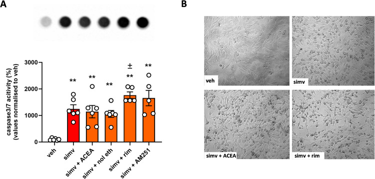 Caspase 3/7 activity in C2C12 myoblasts exposed to simvastatin with or without CB1 drugs.A Measurement caspase 3/7 activation in myoblasts exposed to simvastatin (30 µM) for 24 h in the presence or absence of selective CB1 agonists (ACEA 1 µM or noladin ether 1 µM) or antagonists (rimonabant 1 µM or AM251 1 µM). Each bar is the mean ± S.E.M. from 5 to 6 independent biological samples. ** = p ≤ 0.01 versus the veh group; ± = p ≤ 0.05 versus the group treated with simvastatin alone (B) Representative images captured using bright-field light microscopy (10x magnification) showing the effect of simvastatin (24 h) in myoblasts in the presence of ACEA or rimonabant.
