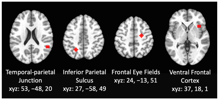 Resting state functional connectivity was assessed using whole brain seed-based analyses using seeds within the DAN and VAN including 6-mm radius spheres centered on the right inferior parietal sulcus, the frontal eye fields, the right ventral frontal cortex, and the right temporal-parietal junction.