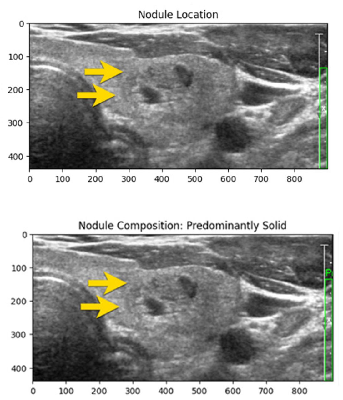 Nodule Detection and Composition Analysis