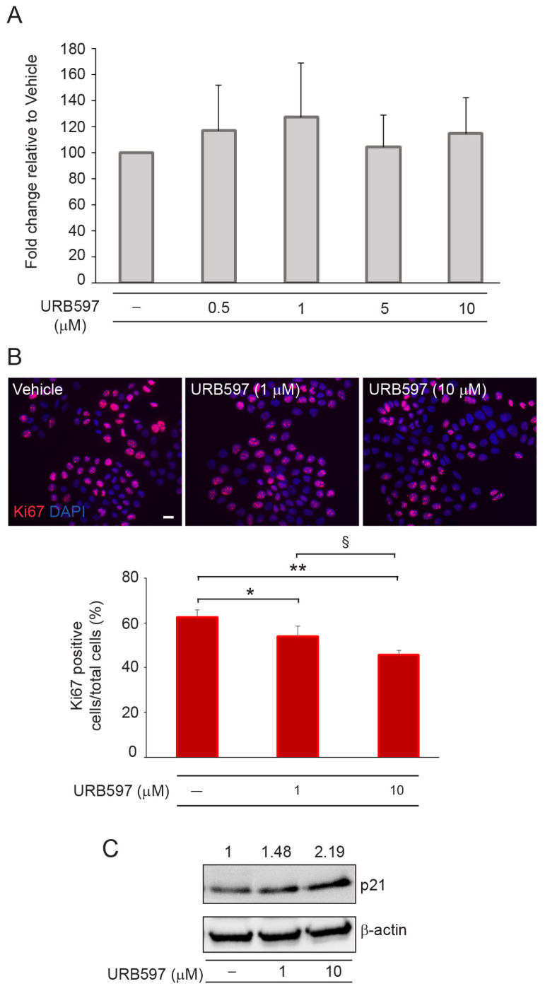 Effects of URB597 on cell viability and proliferative potential of A431 squamous carcinoma cell line. (A) Cell viability evaluated using Neutral Red assay on A431 cells treated with increasing concentrations of URB597 for 48 h. Results are expressed as fold change ± SD relative to vehicle-treated cell value, which was set as 100 by definition. (B) Immunofluorescence and quantitative analysis of Ki67-positive cells in response to 1 μM and 10 μM URB597 treatment. Results are expressed as the mean value ± SD of positive cells/total cells (%). Nuclei are counterstained with DAPI. Scale bar: 20 μm. (C) Western blot of p21 in A431 cells treated with 1 μM and 10 μM doses of URB597 in the presence or absence of URB597. Representative blots are shown. β-actin was used as an endogenous loading control. Densitometric scanning of band intensities was performed to quantify the change in protein expression. Results are expressed as fold change ± SD relative to vehicle-treated cell value, which was set as 1-fold in each case. * p < 0.05 vs. vehicle-treated cells; ** p < 0.01 vs. vehicle-treated cells; § p < 0.05 vs. 1 μM URB597-treated cells.