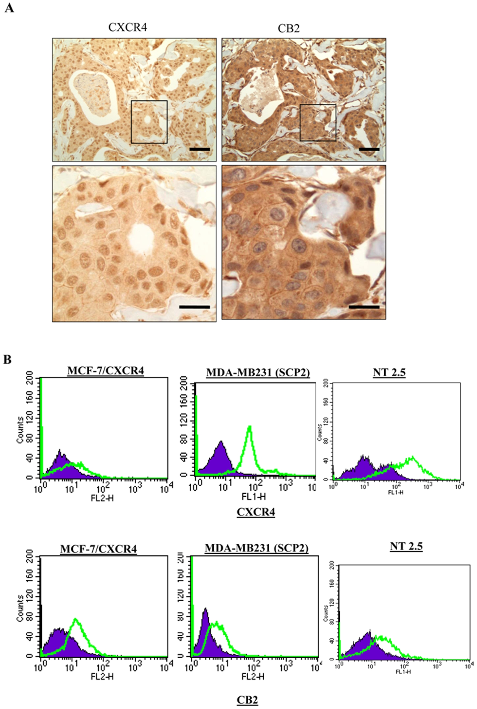 Expression of CXCR4 and CB2 receptors in primary breast cancer tissues and cell lines.(A) Representative photomicrographs of immunohistochemical staining of primary breast cancer tissues showing CXCR4 and CB2 staining. Scale bars 50 µm and 200 µm. (B). FACS analysis of cell surface expression of CXCR4 and CB2 in MCF-7/CXCR4, SCP2 and MMTV-neu (NT 2.5) cells.