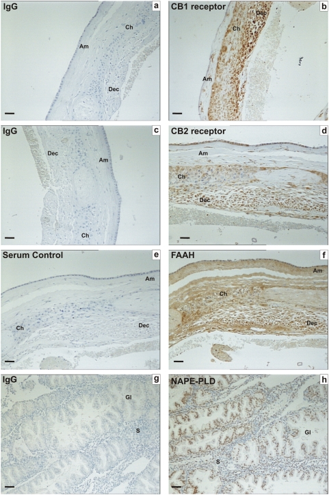 Immunohistochemical staining for CB1, CB2, FAAH and NAPE-PLD on control tissues.Images on the left side of the panel represent the negative control (IgG/serum) and images on the right side of the panel are sections incubated with specific antibodies/antisera. The tissues used in a–f are human fetal membranes whereas g and h are human endometrium. CB1, CB2 and FAAH Immunoreactivity was observed in the amnion (Am), chorion (Ch) and decidua (Dec) of term fetal membranes, whilst NAPE-PLD immunoreactivity was observed mainly in the endometrial glands (Gl) with sparse staining in endometrial stroma (S). The images are representatives from at least six samples and were taken at 200× magnification. Bar = 50 µm.