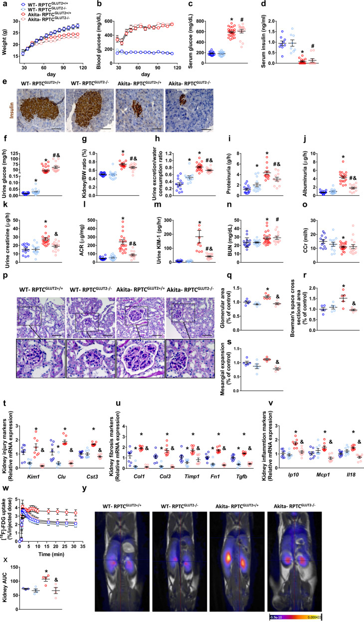 Genetic reduction of GLUT2 in RPTCs protects mice from developing DKD.All the following measurements were done in Akita diabetic mice and their littermate WT controls with or without reduced expression of GLUT2 in RPTCs: a Body weight surveillance for a period of 16 weeks. n = 16 mice for WT-RPTCGLUT2+/+, n = 17 mice for WT-RPTCGLUT2−/−, n = 20 mice for Akita-RPTCGLUT2+/+, n = 17 mice for Akita-RPTCGLUT2−/−. b Blood glucose surveillance for a period of 16 weeks. n = 16 mice for WT-RPTCGLUT2+/+, n = 17 mice for WT-RPTCGLUT2−/−, n = 20 mice for Akita-RPTCGLUT2+/+, n = 17 mice for Akita-RPTCGLUT2−/−. c Serum glucose. n = 16 mice for WT-RPTCGLUT2+/+, n = 17 mice for WT-RPTCGLUT2−/−, n = 20 mice for Akita-RPTCGLUT2+/+, n = 17 mice for Akita-RPTCGLUT2−/− (*P < 0.0062, #P = 0.0002, &P = 0.0082). d Serum insulin. n = 9 mice for WT-RPTCGLUT2+/+, n = 8 mice for WT-RPTCGLUT2−/−, n = 15 mice for Akita-RPTCGLUT2+/+, n = 10 mice for Akita-RPTCGLUT2−/− (*P < 0.0437, #P = 0.0001). e Representative insulin immunohistochemistry staining in the pancreas, 40× magnification, scale bar: 50 µm. f Urinary glucose levels. n = 16 mice for WT-RPTCGLUT2+/+, n = 17 mice for WT-RPTCGLUT2−/−, n = 20 mice for Akita-RPTCGLUT2+/+, n = 17 mice for Akita-RPTCGLUT2−/− (*P < 0.0062, #P < 0.0001, &P = 0.0288). g Kidney-to-body weight ratio. n = 16 mice for WT-RPTCGLUT2+/+, n = 17 mice for WT-RPTCGLUT2−/−, n = 20 mice for Akita-RPTCGLUT2+/+, n = 17 mice for Akita-RPTCGLUT2−/− (*P < 0.0001, #P < 0.0001, &P = 0.0187). h Urine exertion-to-water consumption ratio. n = 16 mice for WT-RPTCGLUT2+/+, n = 17 mice for WT-RPTCGLUT2−/−, n = 20 mice for Akita-RPTCGLUT2+/+, n = 17 mice for Akita-RPTCGLUT2−/− (*P < 0.0062, #P = 0.0002, &P = 0.0082). i Urinary protein levels. n = 14 mice for WT-RPTCGLUT2+/+, n = 13 mice for WT-RPTCGLUT2−/− and Akita-RPTCGLUT2+/+, n = 11 mice for Akita-RPTCGLUT2−/− (*P < 0.0418, #P = 0.0389, &P = 0.0282). j Urinary albumin levels. n = 15 mice for WT-RPTCGLUT2+/+, n = 15 mice for WT-RPTCGLUT2−/−, n = 18 mice for Akita-RPTCGLUT2+/+, n = 13 mice for Akita-RPTCGLUT2−/− (*P < 0.0001, #P = 0.0030, &P < 0.0001). k Urinary creatinine levels. n = 13 mice for WT-RPTCGLUT2+/+, n = 14 mice for WT-RPTCGLUT2−/−, n = 20 mice for Akita-RPTCGLUT2+/+, and n = 14 mice for Akita-RPTCGLUT2−/− (*P < 0.0001, &P = 0.0019). l Urine albumin-to-creatinine ratio (ACR). n = 14 mice for WT-RPTCGLUT2+/+, n = 14 mice for WT-RPTCGLUT2−/−, n = 20 mice for Akita-RPTCGLUT2+/+, and n = 12 mice for Akita-RPTCGLUT2-/- (*P < 0.0001, #P = 0.0326, &P = 0.0001). m Urinary KIM-1 levels. n = 10 mice for WT-RPTCGLUT2+/+, n = 8 mice for WT-RPTCGLUT2−/−, n = 10 mice for Akita-RPTCGLUT2+/+, and n = 14 mice for Akita-RPTCGLUT2−/− (*P = 0.0010, #P < 0.0001, &P = 0.0011). n Urinary BUN. n = 15 mice for WT-RPTCGLUT2+/+, n = 15 mice for WT-RPTCGLUT2−/−, n = 22 mice for Akita-RPTCGLUT2+/+ and n = 12 mice for Akita-RPTCGLUT2−/− (*P = 0.0261, #P = 0.0076). o Creatinine clearance (CCr). n = 12 mice for WT-RPTCGLUT2+/+, n = 12 mice for WT-RPTCGLUT2–/–, n = 20 mice for Akita-RPTCGLUT2+/+, and n = 15 mice for Akita-RPTCGLUT2–/– (*P = 0.0034). p Representative PAS staining of the kidney, 40× magnification, scale bar: 50 µm. q Glomerular area quantification (at least 10 glomeruli per mouse). n = 5 mice per group (*P = 0.0096, &P = 0.0015). r Bowman’s space cross-sectional area quantification (at least 10 glomeruli per mouse). n = 5 mice per group (*P = 0.0160, &P = 0.0075). s Mesangial expansion quantification (at least 10 glomeruli per mouse). n = 5 mice for WT-RPTCGLUT2+/+ and WT-RPTCGLUT2−/−, n = 4 mice for Akita-RPTCGLUT2+/+ and Akita-RPTCGLUT2−/− (&P = 0.0006). t qPCR analysis of kidney injury markers Kim1, Clu, and Cst3. n = 8 mice per group (*P < 0.0091, &P < 0.0001). u qPCR analysis of kidney fibrogenic markers Col1, Col3, Timp1, Fn1, and Tgfb. n = 8 mice per group (*P < 0.0173, &P < 0.0008). v qPCR analyses of kidney inflammatory markers Ip10, Mcp1, and Il18. n = 8 mice per group (*P < 0.0122, &P < 0.0006). w, x Kidney uptake of [18F]-FDG using PET-MRI analysis. n = 3 mice for WT-RPTCGLUT2+/+, n = 4 mice for WT-RPTCGLUT2−/−, Akita-RPTCGLUT2+/+ and Akita-RPTCGLUT2−/− (*P = 0.0139, &P = 0.0224). y Representative kidneys PET-MRI images. Data represent the mean ± SEM and were analyzed by one-way ANOVA followed by Tukey test (one-sided). *P < 0.05 relative to the WT-RPTCGLUT2+/+ mice; #P < 0.05 relative to WT-RPTCGLUT2−/− mice; &P < 0.05 relative to the Akita-RPTCGLUT2+/+ mice. Source data are provided as a Source Data file.
