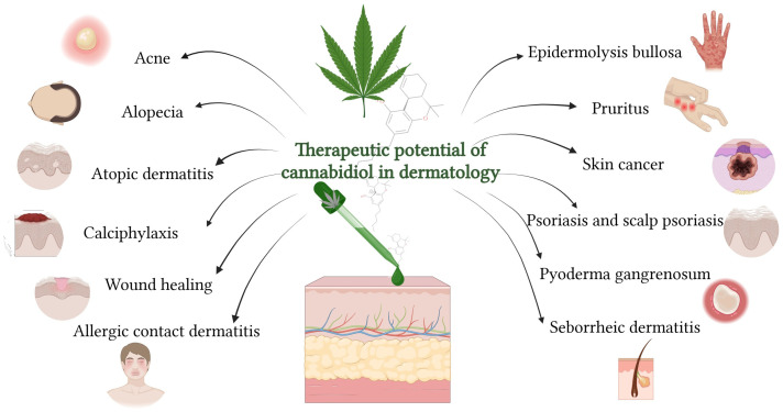 Potential of cannabidiol (CBD) in dermatology (created with BioRender.com).