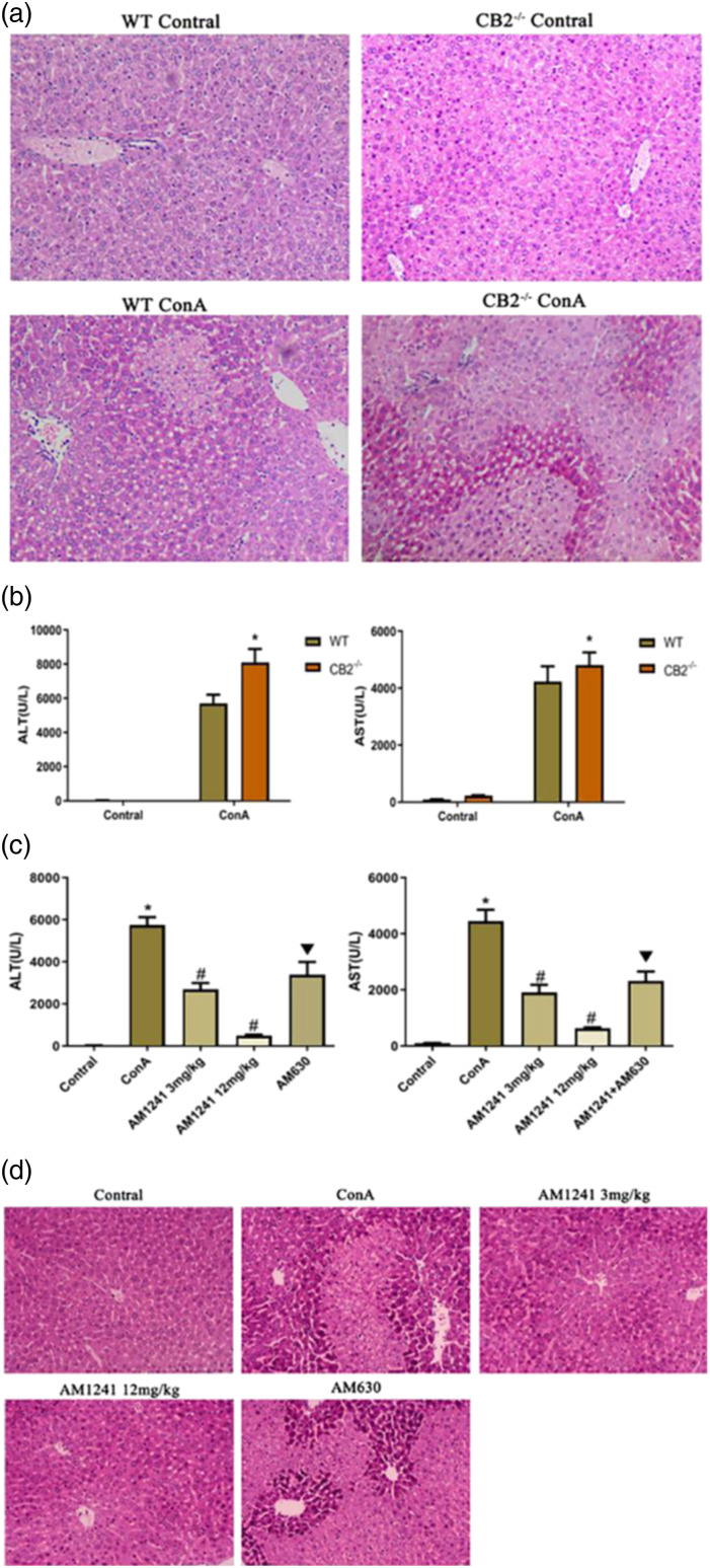 The effect of AM1241 and the cannabinoid type II receptor on ConA-induced autoimmune hepatitis. (a) Photomicrographs of representative livers collected 9 h after ConA injection in cannabinoid type II receptor−/− mice and wild-type mice and stained with H&E, ×200 magnification. (b) Protection of mouse liver by the cannabinoid type II receptor gene. Data are expressed as the mean ± SEM (n = 6; *p < 0.05 for cannabinoid type II receptor −/− group versus wild-type group). (c) Effects of AM1241 on plasma alanine transaminase and aspartate transaminase levels in wild-type C57 mice. Data are expressed as the mean ± SEM (n = 8; #p < 0.05 for ConA versus control; *p < 0.05 for AM1241 groups versus ConA; ▼p < 0.05 for AM630 versus AM1241 groups). (d) Photomicrographs of representative livers collected 9 h after ConA injection and stained with haematoxylin and eosin, ×200 magnification.