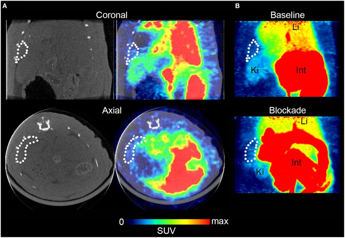 Rat spleen PET/CT images after injection of [11C]AAT-015 (averaged 0–60 min post injection). (A) Coronal and axial slices of the abdominal region. Spleen is encircled in the CT and PET/CT images, demonstrating low uptake of [11C]AAT-015. SUV max = 4. (B) Maximal intensity projection (MIP) images of the abdominal region under baseline (same rat as in A) and blockade conditions (injection of 1.5 mg/kg GW405833 shortly before radiotracer). Spleen is encircled. Li, liver; Ki, kidney; Int, intestine. SUV max = 6.