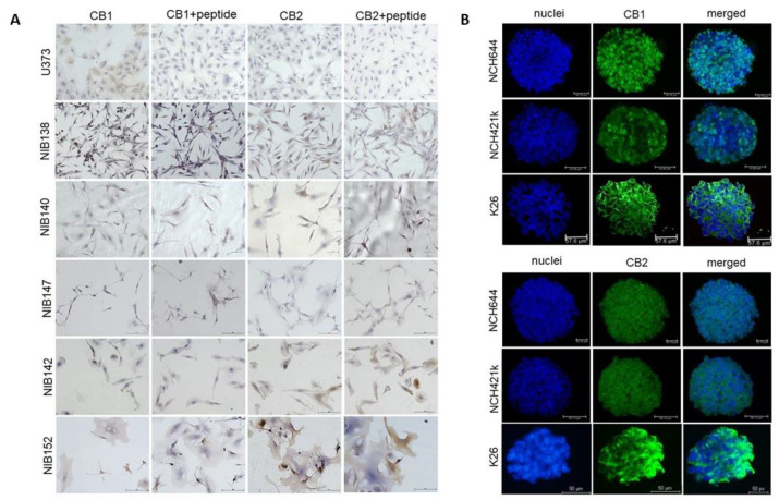 CB1 and CB2 receptors are differentially expressed in GB cells and GSCs. (A) Immunocytochemical staining of CB1 and CB2 receptors (brown) in GB cell lines established from patient tumour samples. Cell nuclei were counterstained with haematoxylin (blue), as described in detail in Materials and Methods (Section 2.7 and Section 2.8). Scale bars: 50 µm. (B) Immunofluorescence staining of CB1 and CB2 receptors in the spheroids of two established GSCs and the patient-derived GSC cell line K26. Cell nuclei were counterstained with DAPI (blue), and the receptors CB1 and CB2 were stained with Alexa Fluor 488 (green). Scale bars: 50 µm.
