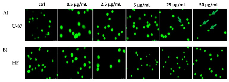 Representative images of U-87 and HF cells treated with different LnHS doses and subjected to the comet assay (panels A and B respectively). ctrl: untreated cells; green arrows indicate comets with a tail. Experiments were performed in duplicate.