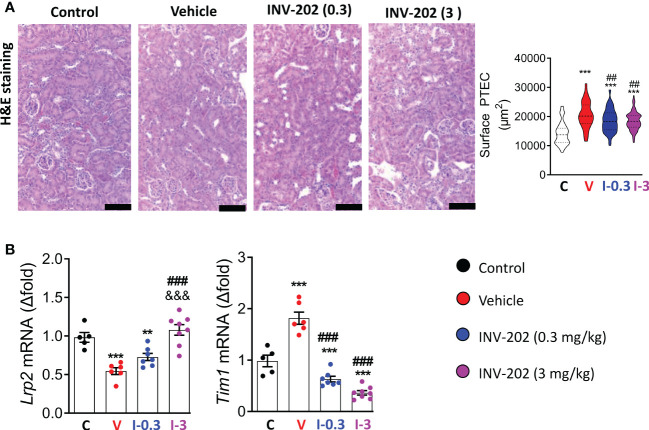 INV-202 treatment effects on proximal tubule cells. (A) Representative H&E staining of kidney slides with analysis of mean surface area of PTECs (scale: 100 µm). (B) mRNA analysis of Lrp2 and Tim1 coding for megalin and KIM1, respectively. Statistical significance versus nondiabetic control: **p < 0.01; ***p < 0.001; versus vehicle: ##p < 0.01; ###p < 0.001; versus INV-202 group, 0.3 mg/kg: &&&p < 0.001. H&E, hematoxylin and eosin; KIM1, kidney injury molecule 1; PTEC, proximal tubular epithelial cell. C: non-diabetic control mice, V: Vehicle-treated diabetic mice, I-0.3: INV-202-treated diabetic mice (0.3 mg/kg), I-3: INV-202-treated diabetic mice (3 mg/kg).
