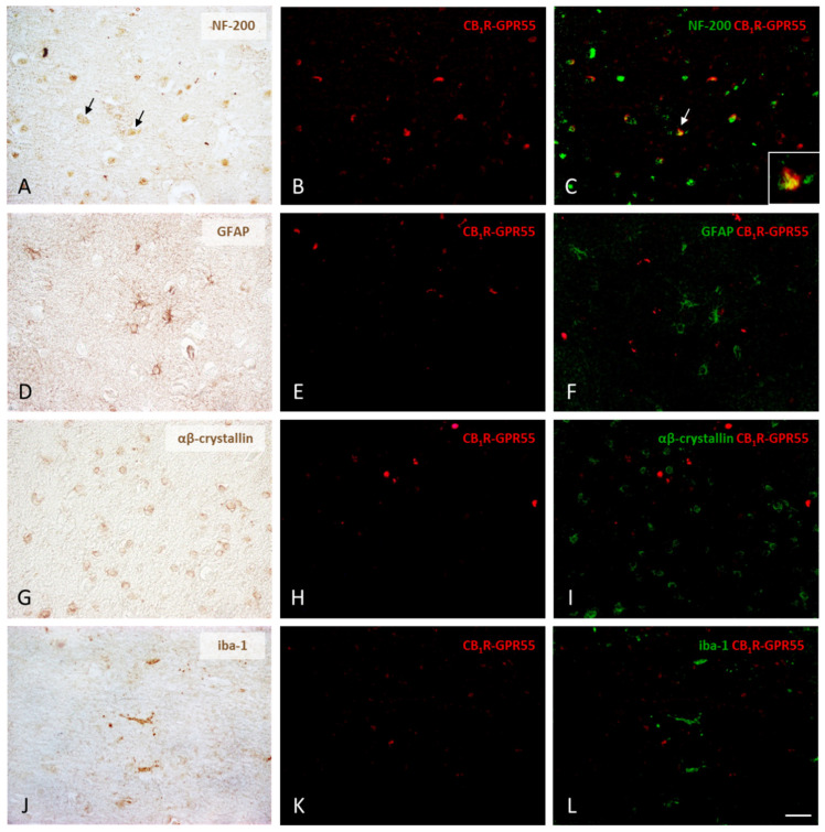 Expression of CB1R-GPR55 heteromers in neurons, astrocytes, oligodendrocytes, and microglia in the prefrontal cortex of the control subjects. Following the chromogenic immunohistochemical detection of the four different types of cells, those positive for NF-200, GFAP, αβ-crystallin, and iba-1 (A,D,G,J), CB1R-GPR55 heteromers were identified as red dots in cells with DAPI-stained nuclei using the PLA method (B,E,H,K). Digital overlays of PLA images (red fluorescent signal) and DAB immunolabeling images (the DAB signal converted into a green color) clearly show that only neurons express CB1R-GPR55 receptor complexes (arrows), whereas oligodendrocytes, astrocytes, and microglia completely lack them (C,F,I,L). 40×. Detail: 100×. Scale bar 50 µm.