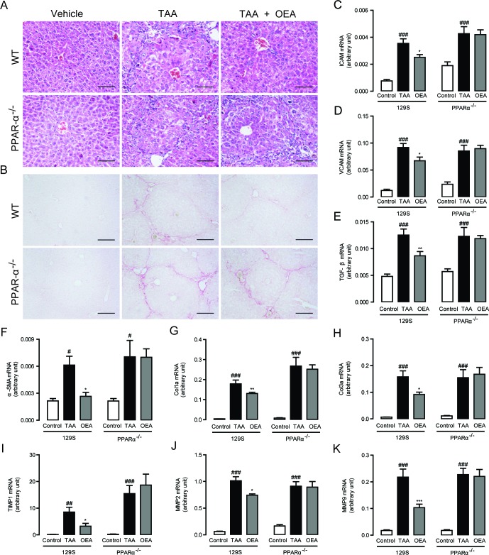 Anti-fibrotic effects of OEA in TAA-induced fibrosis mice were mediated by PPAR-α activationA.-B. Hematoxylin-eosin (HE) and Sirius red staining of liver sections. C.-K. Hepatic mRNA levels of ICAM, VCAM, TGF-β, α-SMA, Col1a, Col3a, TIMP1, MMP-2, and MMP-9 were determined by quantitative real-time PCR analysis. Results from wild-type (WT) mice and PPAR-α knockout mice with saline treatment, TAA treatment (160 mg/kg, i.p.), TAA treatment combined with OEA administration (5 mg/kg/day, i.p.). Data are shown as means ± s.e.m.; n = 6-8 in each group. ## P < 0.01, ### P < 0.001, * P < 0.05, ** P < 0.01, *** P < 0.001. Scale bars: 100 μm (A), 200μm (B).