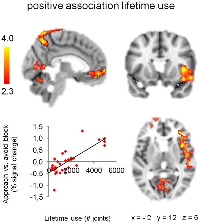 Association approach-bias activation patterns and lifetime cannabis use.Approach-bias activation patterns in right insula, medial frontal gyrus, precuneus, cerebellum, and occipital cortex are positively associated with lifetime cannabis use among heavy cannabis users. Scatter plot shows association lifetime use and average percent signal change extracted from significant clusters. Clusters of significant activation (Z >2.3, whole-brain cluster-corrected at p<0.05) are overlaid on a standard MNI brain. Right side of the brain is depicted at right side.