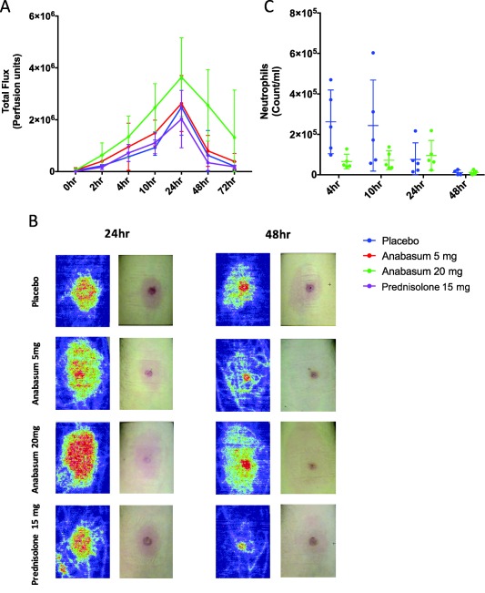 Anabasum alters vascular hyperemia at the site of UVkEc triggered self‐resolving dermal inflammation. Healthy male volunteers were randomized to receive by oral route either placebo, 5 mg anabasum, 20 mg anabasum, twice daily, or 15 mg prednisolone once daily for 4 days. On the fourth day, acute inflammation was triggered by intradermal injection of 1.5 × 107 UV‐killed E. coli (UVkEc) suspended in 100 μL of saline in both forearms. Vascular hyperemia at the injection site was assessed at specified intervals by a laser Doppler imager. The comparison of vascular hyperemia (mean ± SD) between the four treatment groups (a), the representative Doppler flux images at 24 h and 48 h in the four treatment groups (b) and the neutrophil count at 24 h and 48 h in the placebo and 20 mg anabasum (c) are shown. Data expressed as individual values with mean ± SD. n = 5/group.