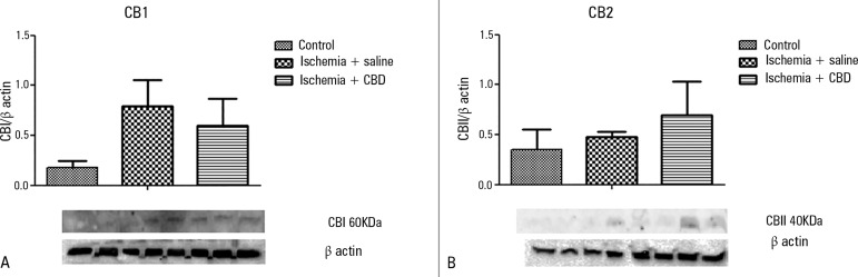 The effect of cannabidiol treatment on the CB1 and CB2 levels after renal ischemia reperfusion injury. Animals were sham operated or had their renal pedicle clamped bilaterally for 45 minutes. Immediately before unclamping, a single dose of cannabidiol (5mg/kg) or saline was administered. Twenty-four hours later, the CB1 (A) and CB2 (B) levels were measured in the kidneys.CBD - cannabidiol. The results were expressed as the relative ratio between the blot and the β-actin immunocontent. Order of bands: two bands Control; three bands Ischemia + saline; three bands Ischemia + CBD.