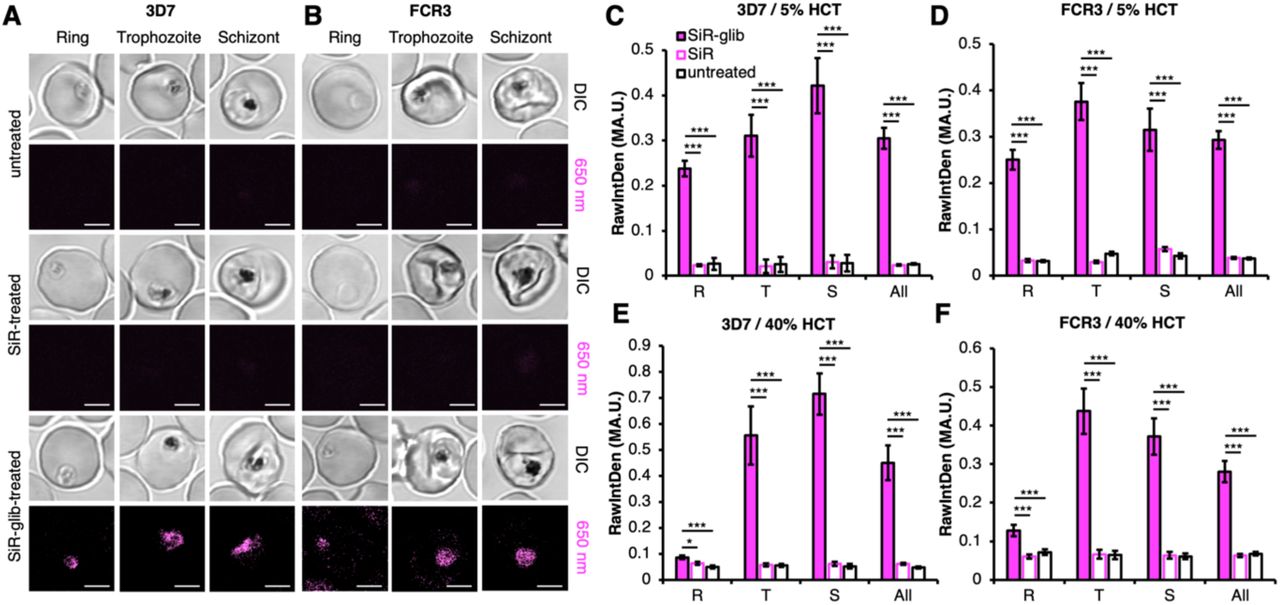 Labeling of two different P. falciparum strains with SiR-glib.A) The P. falciparum strain 3D7 was grown in a 5% HCT culture. Cells were labeled with 2 µM SiR-glib, 2 µM SiR or remained untreated for 1 h. Only SiR-glib-treated cells showed a specific labeling of the ring (R), trophozoite (T) and schizont (S) developmental stages of the parasite for both investigated strains. Signals of all stages are included (All). Scale bars = 3 µm. B) As for (A) but using the P. falciparum strain FCR3. C, D) Quantification of fluorescence from (A) and (B) reveals a significantly stronger fluorescence of SiR-glib-treated RBCs compared to using SiR or untreated RBCs in every developmental stage. N=3; n≥11. *: p < 0.05; **: p < 0.01; ***: p < 0.001. E, F) As for (C) and (D) but in a 40% HCT culture shows lower signal in ring stages when compared to 5% HCT. N=3; n≥12. *: p < 0.05; **: p < 0.01; ***: p < 0.001.