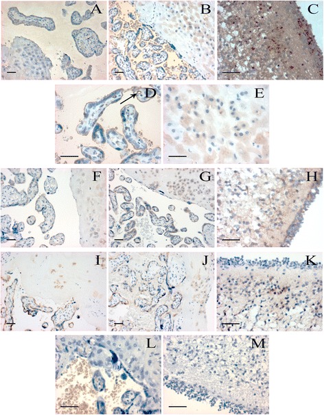 Localization of CB1, CB2 and FAAH in human placental villi, decidua and cerebellum. CB1 specific staining is shown in normal (A) and preeclamptic (B) placental tissues, images were captured at 200× magnification. Further images demonstrate strong CB1 positivity in preeclamptic placental villi (D) and decidua (E) at 400× magnification. Arrow indicates strong CB1 immunoreactivity in villous capillary endothelial cells. Positive control reaction for CB1 is revealed in human cerebellum (C). CB2 specific staining is shown in normal (F) and preeclamptic (G) placental tissues, and in human cerebellum (H) as a positive control. FAAH specific staining is presented in normal (I) and preeclamptic (J) placental tissues, and in human cerebellum (K) as a positive control. Negative controls are shown in human placental villi and decidua (L), and in human cerebellum (M). Placental tissue samples from normal pregnancy and preeclampsia were captured at 200× magnification, while positive and negative controls were taken at 400× magnification; bar =100 μm.