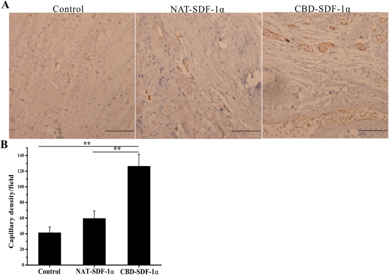 Histological analysis of capillary density in the ischemic area using antibody to vWF.(A) Representative images of vWF staining. (B) Average blood vessel density (n = 8 in each group). CBD-SDF-1α increased the capillary density in the ischemic area. The data are presented as the means ± SEM, **P < 0.01. Scale bar = 50 μm.