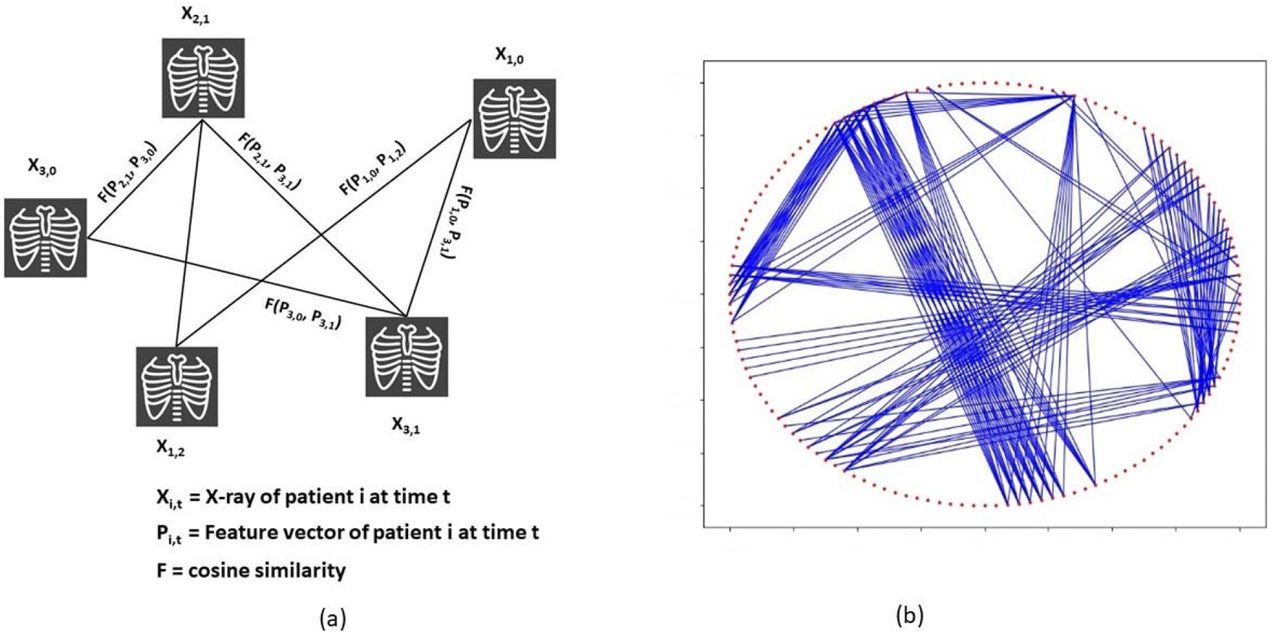 Graph formation based on chest X-rays and patient similarity information; a) sample graph construction, b) 1% random subsample of an actual graph – red dots are nodes indicated by chest X-rays in sample graph, blue lines are edges which are constructed between nodes when similarity between corresponding patient features exceed a certain threshold.