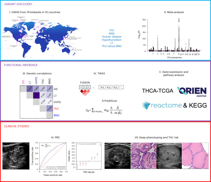 Study design.I. The VTB Consortium was established within the framework of the GBMI. The participating biobanks performed GWAS for five thyroid diseases. II. An inverse-variance-weighted meta-analysis was conducted after quality control procedures. Previously known and new independent genetic associations were identified. III. Functional inference studies included genetic correlation analysis with cov-LDSC. Asterisks denote Benjamini–Hochberg false discovery rate (FDR) < 0.05. IV. TWAS (FUSION and S-PrediXcan). V. Pathway (KEGG and Reactome) and gene expression analyses (TCGA and ORIEN AVATAR). VI. PRS were developed for ThC, benign thyroid diseases and to distinguish malignant and benign thyroid nodules. VII. PRS were tested for association with thyroid diseases and aggressive ThC features extracted from clinical charts and surgical histopathology reports.