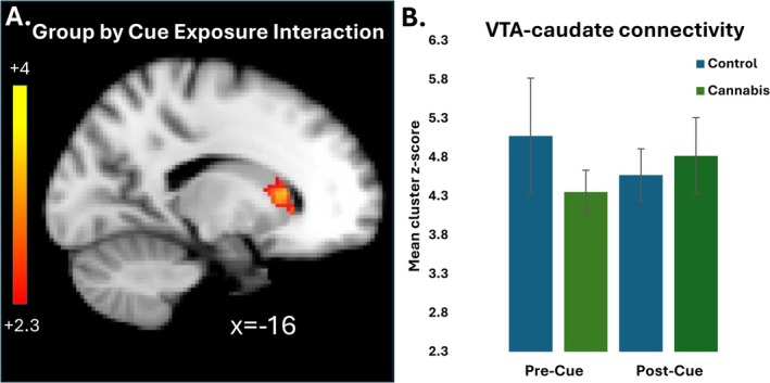 Group × time interaction in ventral tegmental area (VTA)‐striatal resting‐state connectivity. (A) Sagittal image cluster shows the significant interaction effect in VTA connectivity with the head of the caudate nucleus. (B) Bar chart illustrates the mean z‐score of the all the voxels in the caudate cluster at each time point for each group separately (controls = blue, CU = green). CU participants showed increased connectivity following cue expose between the VTA and caudate, while the control participants showed reduced connectivity in VTA connectivity between the two resting‐state scans.