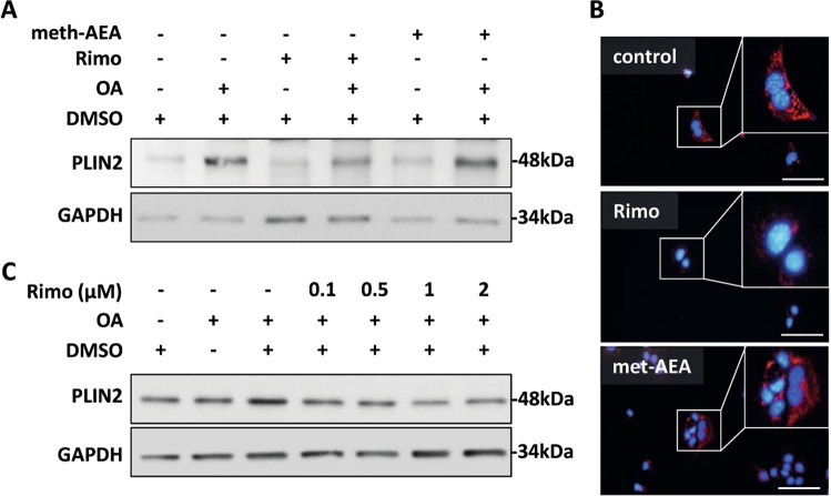 Pharmacologic antagonization of CB1 reduced PLIN2 expression in cell culture a AML12 cells were treated with rimonabant (rimo) or methanadamide (meth-AEA) at 1 µM final concentration for 48 h in the absence or presence of oleic acid (200 µM). Western blot analysis demonstrated enhanced PLIN2 expression with meth-AEA and reduced PLIN2 expression with rimo-treatment. Equal protein loading was confirmed using anti-GAPDH antibody. A representative Western Blot is shown. b Immunofluorescence analysis of PLIN2 (red) in AML12 cells treated with rimonabant or meth-AEA. Nuclei were stained with DAPI (blue). Representative stainings are shown. Original magnification ×400, bar 100 µm. c Dose dependent decrease in PLIN2 expression in AML12 cells treated with rimonabant at different doses (0.1, 0.5, 1, and 2 µM), respectively. in the presence of oleic acid (200 µM). Cell lysates were analyzed by western blot using specific anti-PLIN2 antibodies. Equal protein loading was confirmed using an anti-GAPDH antibody