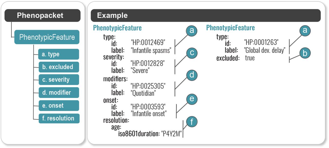 PhenotypicFeatures in a Phenopacket.A Phenopacket can contain information about an arbitrary number of phenotypic features observed in a single individual, each encoded using a PhenotypicFeature element. For medical use cases the subject will generally be a patient or a proband of a study, and the phenotypes will be abnormalities described by an ontology such as the HPO. Each phenotypic feature is defined by an HPO term (a), which is qualified as either present or absent (excluded) (b), with possible severity (c), modifiers (d), onset (e), and resolution (f). The example in the right panel shows a phenotypic feature, severe daily infantile spasms, which first occurred in infancy and resolved at age 4 years and 2 months, in a child without global developmental delay.