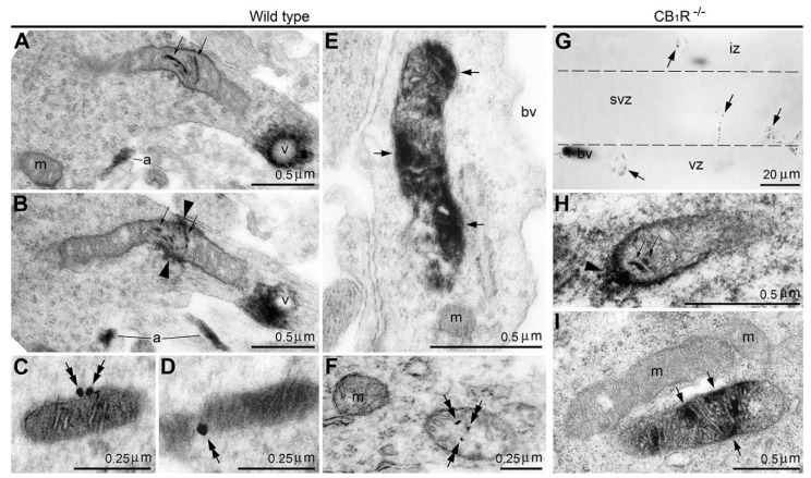 Two types of anti-CB1R immunolabeling of mitochondria in the immature cerebrum of wild-type (A–F) and CB1R−/− (G–I) mice obtained using anti-CB1R serum. (A–D) Serial micrographs of type 1 mitochondria. (A,B) Notice nickel-intensified 3,3′-diaminobenzidine-4HCl (DAB-Ni) immunoprecipitation in the cristae (small arrows) and around the mitochondrion (arrowheads). Known patterns of anti-CB1R immunolabeling are also visible, namely, in the neural processes—putative axons (a) and on the outer surface of intracellular vesicles (v). (C,D) Immunogold–silver particles (double arrows) on the outer surface of the mitochondrion seen in serial sections. (E,F) DAB-Ni immunoprecipitation (arrows in E) and immunogold–silver particles (double arrows in F) label the matrix of type 2 mitochondria, whereas cristae remain immunonegative. (G–I) Anti-CB1R immunolabeling in the CB1R−/− mouse embryo cerebrum. (G) Light micrograph of the neocortex demonstrates numerous immunopositive particles (arrows) in the neuropil and blood vessels (bv), whereas CB1R-expressing axons and cell bodies are absent. (H,I) Electron micrographs show that immunopositive particles seen in (G) represent mitochondria of both types identical to the labeling detected in wild-type animals. Notice stained cristae (small arrows) and staining outside the mitochondrion (arrowhead in H) and matrix staining (arrows in I). The borders between ventricular (vz), subventricular (svz) and intermediate (iz) zones of the embryonic cerebrum are demarked with dashed lines. Abbreviation: m, immunonegative mitochondria. Modified from [6]. (License 6183810481618).