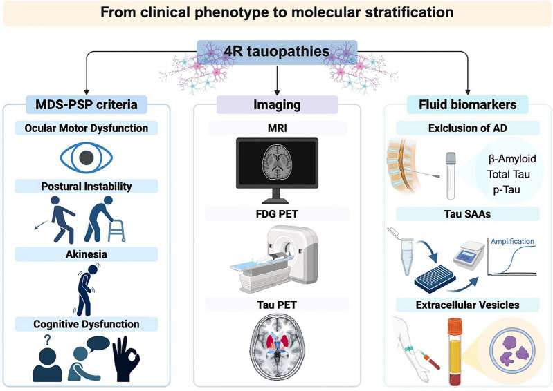Infographic illustrating the assessment of 4R tauopathies, divided into MDS-PSP clinical criteria, imaging, and fluid biomarkers. Clinical criteria include ocular motor dysfunction, postural instability, akinesia, and cognitive dysfunction. Imaging methods shown are MRI, FDG PET, and Tau PET scans. Fluid biomarkers involve tests for exclusion of Alzheimer’s disease, Tau seed amplification assays, and extracellular vesicles.