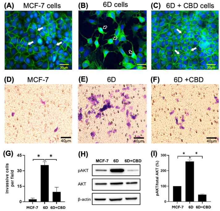 Changes in cell morphology and β-catenin expression in breast cancer cells induced by IL-1β or CBD stimulation. (A) Representative image of cell morphology and β-catenin distribution in the control MCF-7, (B) 6D, and (C) 6D+CBD cells, β-catenin localization in the adherens junctions (full arrows) or in the nuclei (empty arrows) is indicated in each panel. Bar = 20 µm. (D) Representative image of MCF-7 cell invasion through Matrigel-coated Transwell inserts. (E) 6D and (F) 6D+CBD cells. The cells were stained with Giemsa and examined under a light microscope. Five fields per insert were analyzed (Bar = 40 µm). (G) Number of cells that invaded Matrigel-coated inserts is represented as mean ± SD of the obtained values, asterisks indicate significance at p ≤ 0.05. (H) Representative western blot showing AKT and pAKT (Ser 473) levels in MCF-7, 6D, and 6D+CBD cells. (I) Relative expression of the percentage of AKT phosphorylation (expressed as pAKT/Total AKT ratio) in each cell type, asterisks indicate significance at p ≤ 0.05.
